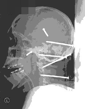 死不了的人未解之谜 盘点人类未解之谜七大神秘事件